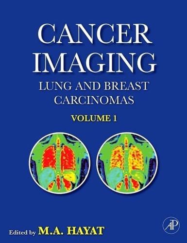 Cancer Imaging By:Hayat, M. A. Eur:39.01 Ден2:8999