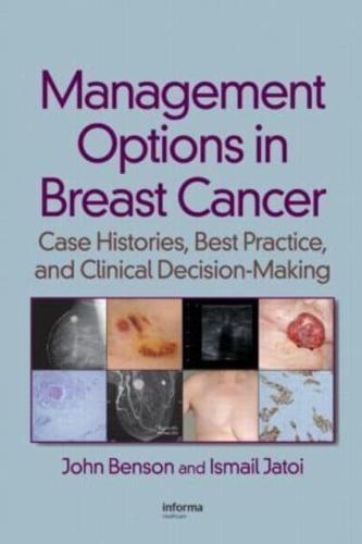 Management Options in Breast Cancer By:Jatoi, Ismail Eur:128.44 Ден1:8999
