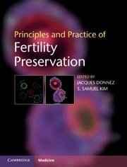 Principles and Practice of Fertility Preservation By:Donnez, Jacques Eur:52,02 Ден1:9299
