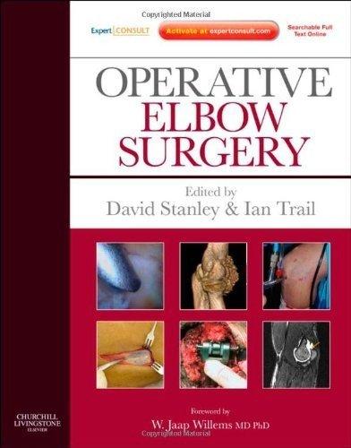 Operative Elbow Surgery : Expert Consult: Online and Print By:Stanley, David Eur:65,02 Ден2:14499