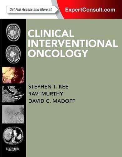 Clinical Interventional Oncology By:David, C. Madoff Eur:95.92 Ден2:7899