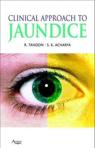 Clinical Approach to Jaundice By:Tandon, Rakesh Eur:65,02 Ден2:1299
