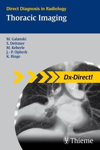 Thoracic Imaging By:Galanski, Michael Eur:40,63 Ден2:2899