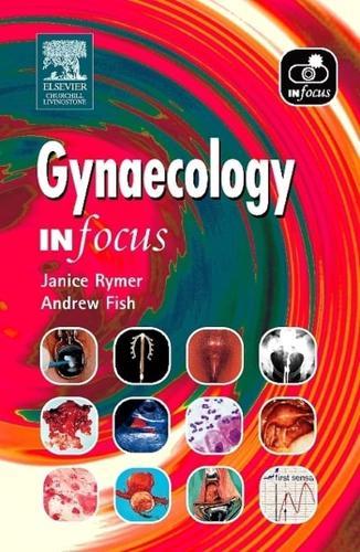 Gynaecology - In Focus By:Fish, Andrew N. J. Eur:255,27 Ден2:1599
