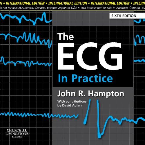 The ECG in Practice By:Hampton, John R Eur:48.76  Ден3:2999