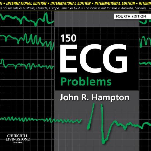 150 ECG Problems By:Hampton, John R Eur:63.40 Ден1:2699