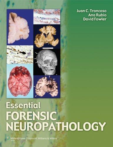 Essential Forensic Neuropathology By:Troncosco, Juan C. Eur:177,22 Ден1:11799