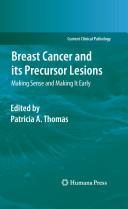 Breast Cancer and its Precursor Lesions By: Eur:82,91 Ден2:5799