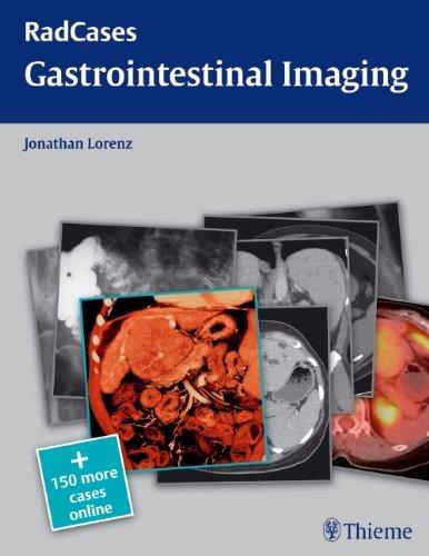 Radcases Gastrointestinal Imaging By:Lorenz, Jonathan M. Eur:336,57 Ден1:3399