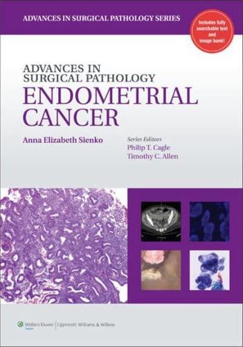 Advances in Surgical Pathology. Endometrial Cancer - Advances in Surgical Pathology By:Sienko, Anna Eur:68.28  Ден3:4199