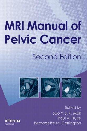 MRI Manual of Pelvic Cancer,Second Edition By:Mak, Soo Eur:201,61 Ден1:8699