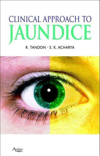 Clinical Approach to Jaundice By:Tandon, Rakesh Eur:39,01 Ден2:1299