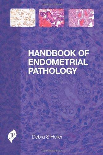 Handbook of Endometrial Pathology By:Heller, Debra S. Eur:235,76 Ден1:2599