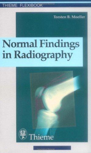 Normal Findings in Radiography : . Zus.-Arb.: Torsten B. Moeller Translated by Terry Telger 190 Illustrations By:Moeller, Torsten Bert Eur:40.63 Ден2:1399