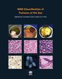 WHO Classification of Tumours of the Eye By: Eur:42,26 Ден1:5099